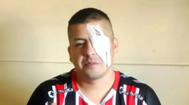 Perdió la visión de su ojo izquierdo tras ser herido durante la represión y denunció a Patricia Bullrich