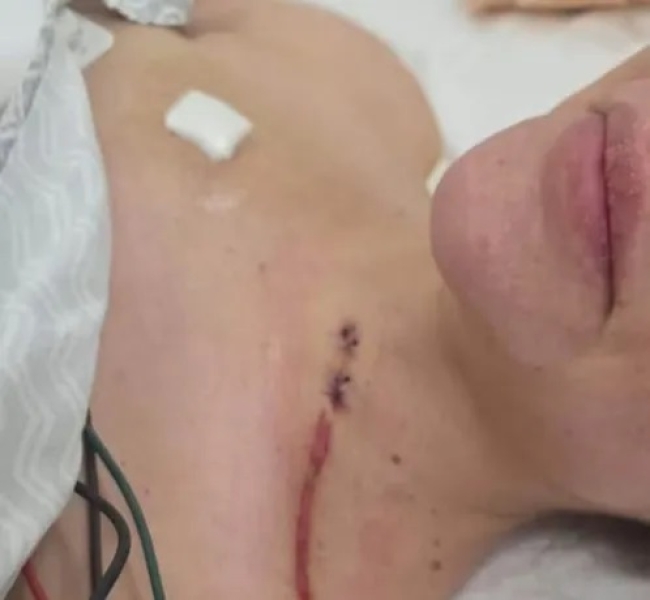 Bolivia: Nadia Beller compartió imágenes de sus heridas tras el ataque