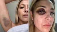 Violencia de género: Se conocieron fotos y chats de la denuncia de Fabiola Yañez contra el expresidente Alberto Fernández