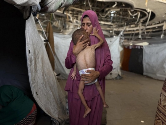 Franja de Gaza: La desnutrición mata a cinco personas, incluido un bebe y 2 niños, en las últimas 24 horas