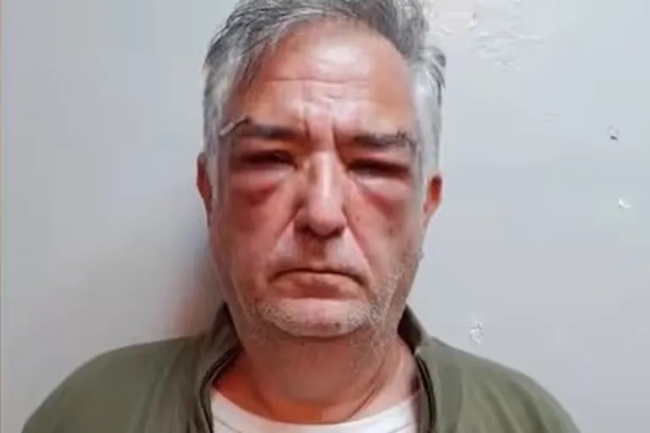 Condenado por proxenetismo, Miguel Calvete reaparece vinculado a operadores, financieras y contratistas ligados a la Andis